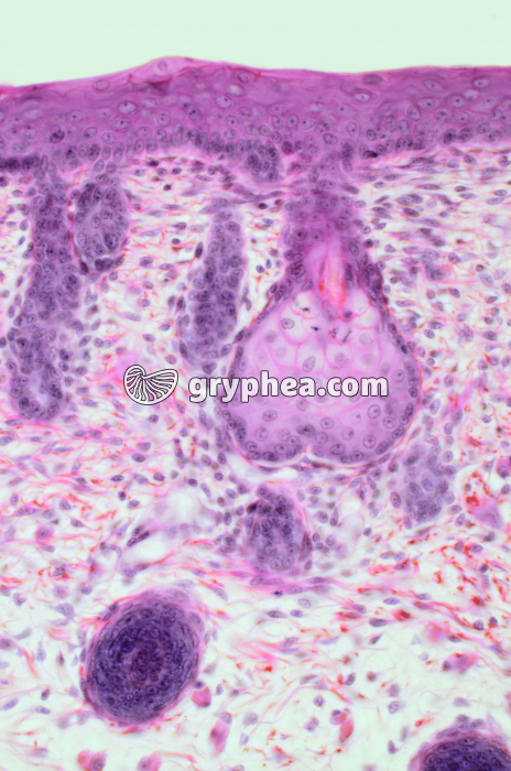 Peau d'Embryon Souris montrnt les ébauches de follicules pileux et les glandes sébacées x40 - gryphea.com